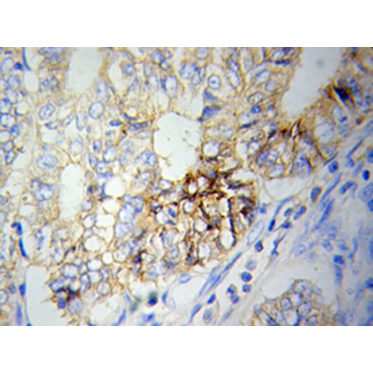 Immunohistochemistry - NAMPT Antibody from Signalway Antibody (32047) - Antibodies.com