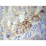 Immunohistochemistry - NAMPT Antibody from Signalway Antibody (32047) - Antibodies.com