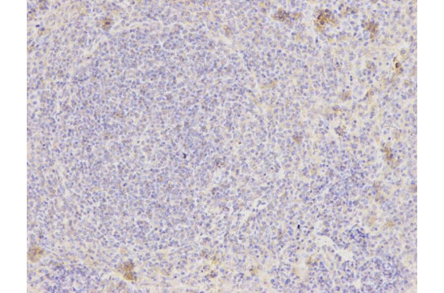Immunohistochemistry - NAMPT Antibody from Signalway Antibody (32047) - Antibodies.com