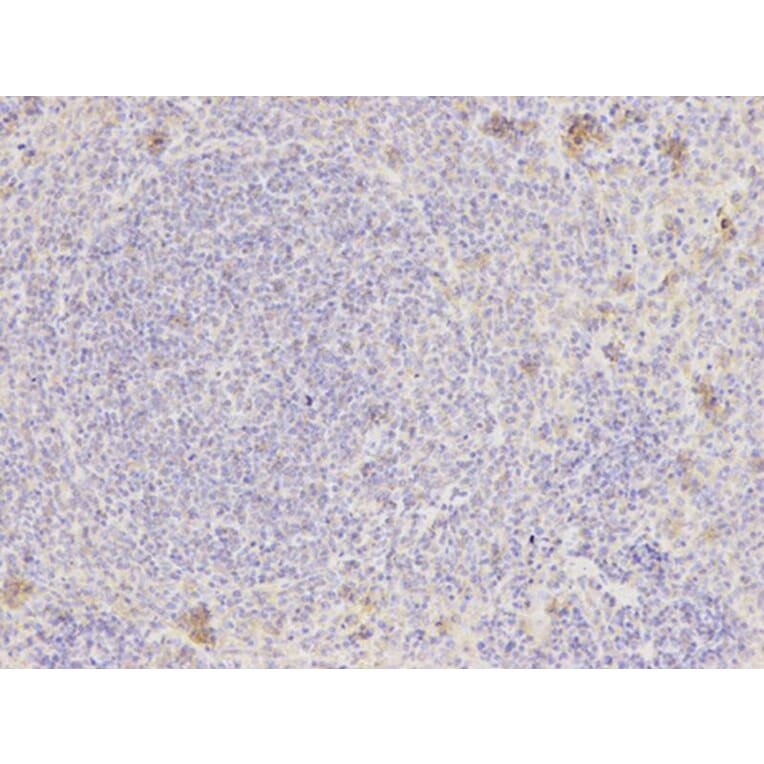 Immunohistochemistry - NAMPT Antibody from Signalway Antibody (32047) - Antibodies.com