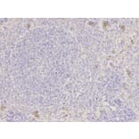 Immunohistochemistry - NAMPT Antibody from Signalway Antibody (32047) - Antibodies.com