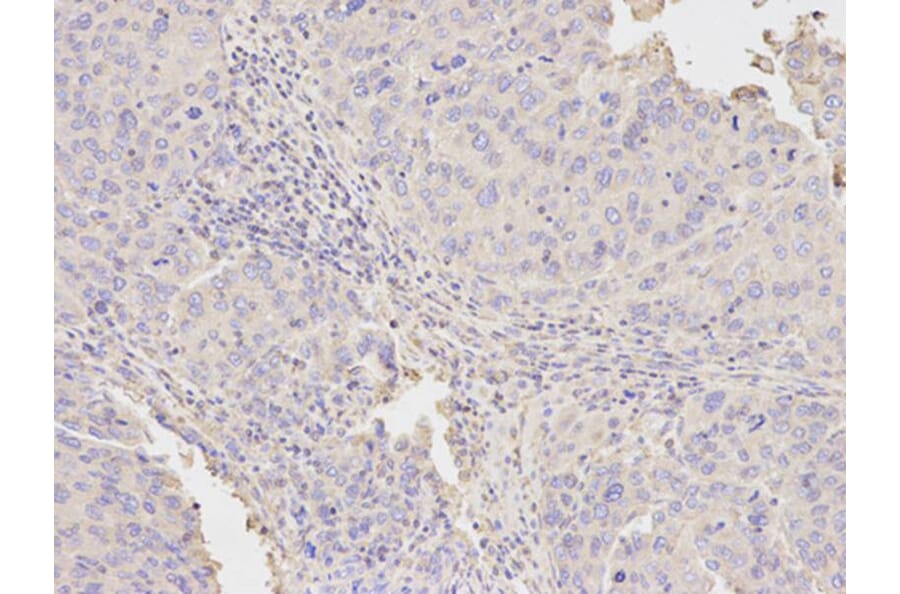 Immunohistochemistry - NAMPT Antibody from Signalway Antibody (32047) - Antibodies.com