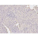 Immunohistochemistry - NAMPT Antibody from Signalway Antibody (32047) - Antibodies.com