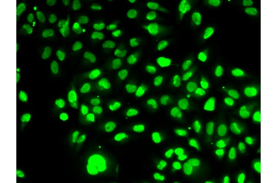 Immunofluorescence - NAMPT Antibody from Signalway Antibody (32047) - Antibodies.com