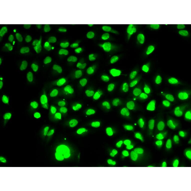 Immunofluorescence - NAMPT Antibody from Signalway Antibody (32047) - Antibodies.com