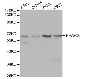 Western blot - PPARG Antibody from Signalway Antibody (32055) - Antibodies.com