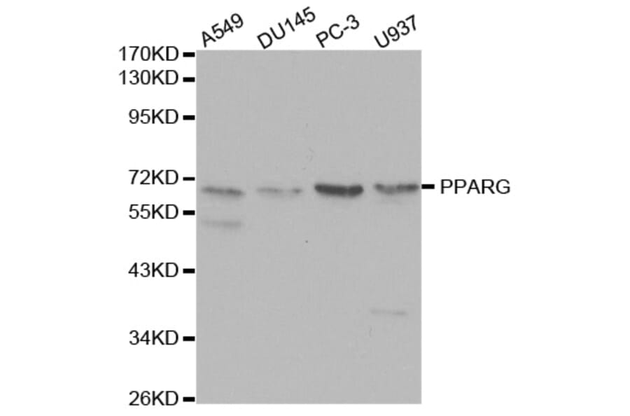 Western blot - PPARG Antibody from Signalway Antibody (32055) - Antibodies.com