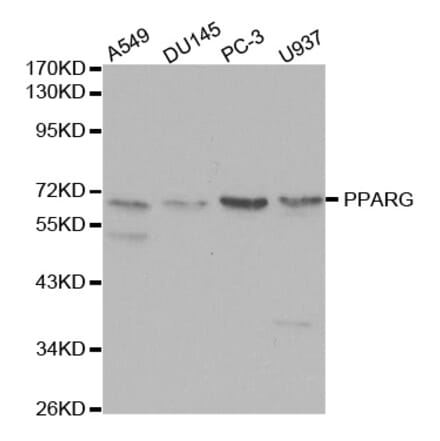Western blot - PPARG Antibody from Signalway Antibody (32055) - Antibodies.com