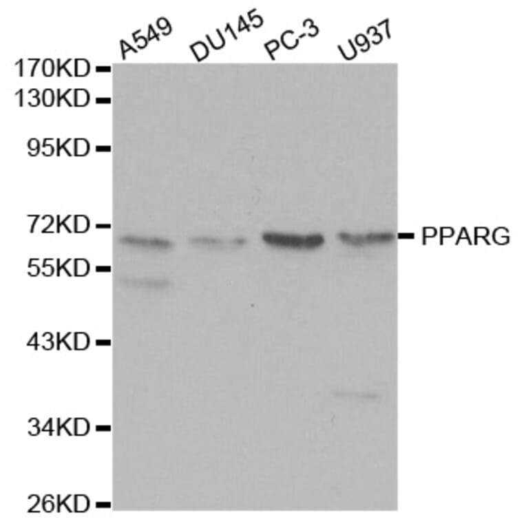 Western blot - PPARG Antibody from Signalway Antibody (32055) - Antibodies.com