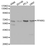 Western blot - PPARG Antibody from Signalway Antibody (32055) - Antibodies.com