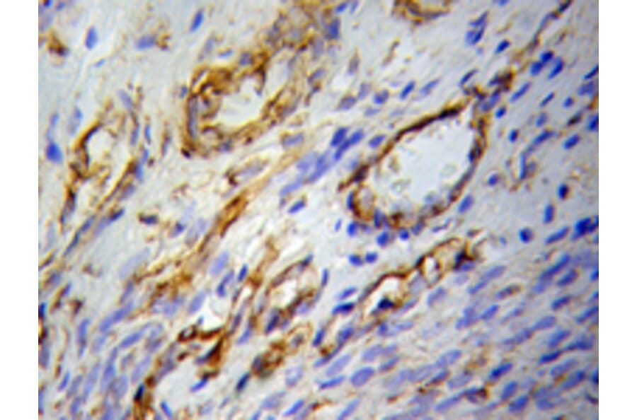 Immunohistochemistry - PPARG Antibody from Signalway Antibody (32055) - Antibodies.com
