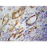 Immunohistochemistry - PPARG Antibody from Signalway Antibody (32055) - Antibodies.com