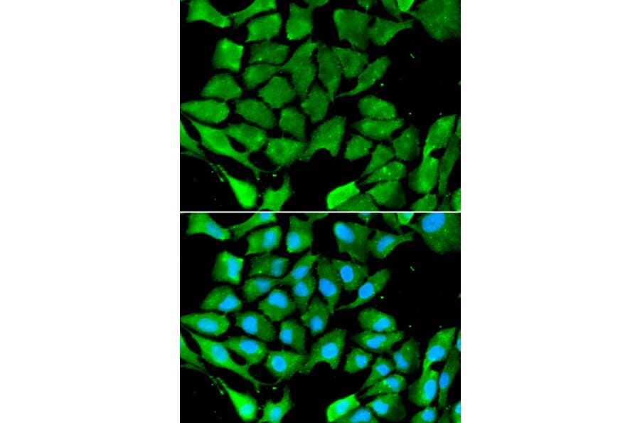 Immunofluorescence - PPARG Antibody from Signalway Antibody (32055) - Antibodies.com