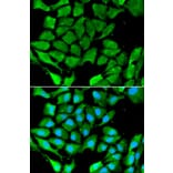 Immunofluorescence - PPARG Antibody from Signalway Antibody (32055) - Antibodies.com
