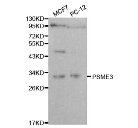 Western blot - PSME3 Antibody from Signalway Antibody (32056) - Antibodies.com