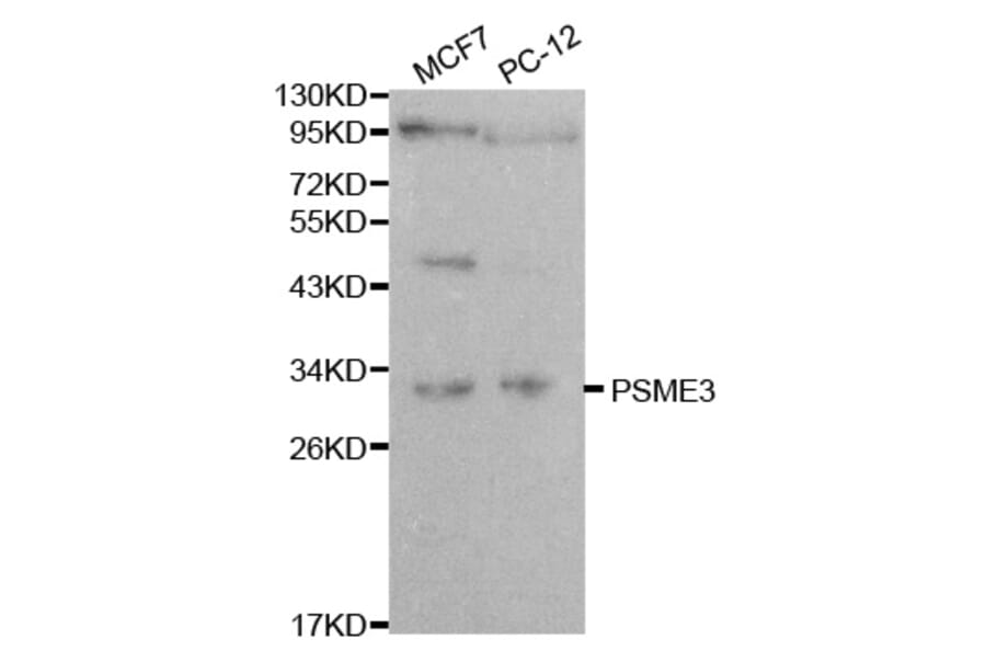 Western blot - PSME3 Antibody from Signalway Antibody (32056) - Antibodies.com