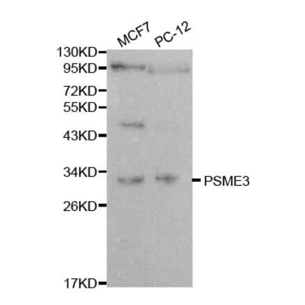 Western blot - PSME3 Antibody from Signalway Antibody (32056) - Antibodies.com