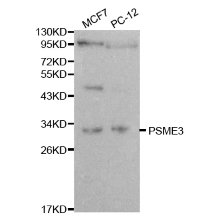 Western blot - PSME3 Antibody from Signalway Antibody (32056) - Antibodies.com