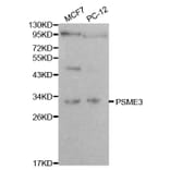 Western blot - PSME3 Antibody from Signalway Antibody (32056) - Antibodies.com