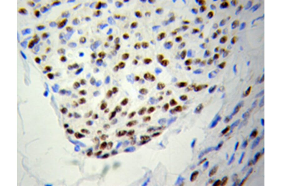 Immunohistochemistry - PSME3 Antibody from Signalway Antibody (32056) - Antibodies.com