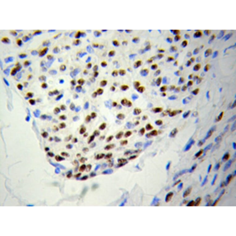 Immunohistochemistry - PSME3 Antibody from Signalway Antibody (32056) - Antibodies.com