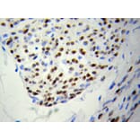 Immunohistochemistry - PSME3 Antibody from Signalway Antibody (32056) - Antibodies.com