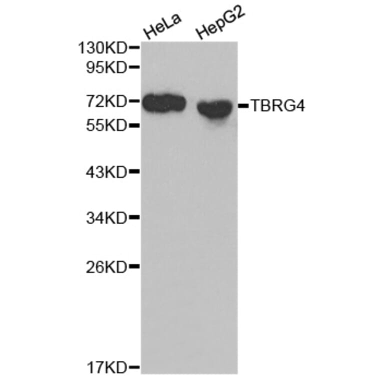 Western blot - TBRG4 Antibody from Signalway Antibody (32060) - Antibodies.com