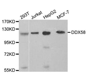 Western blot - DDX58 Antibody from Signalway Antibody (32076) - Antibodies.com