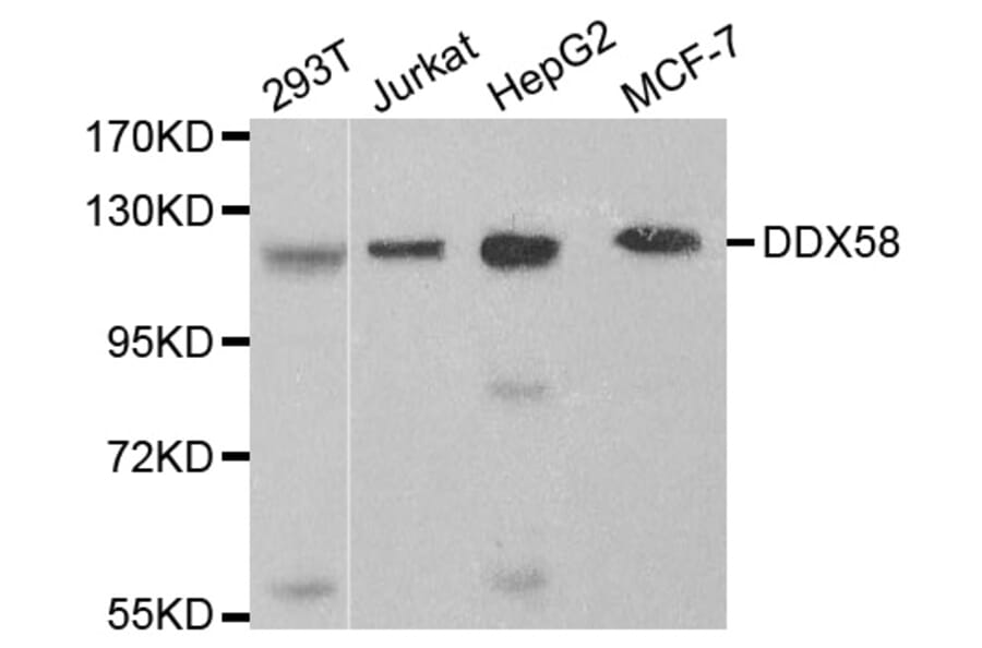 Western blot - DDX58 Antibody from Signalway Antibody (32076) - Antibodies.com