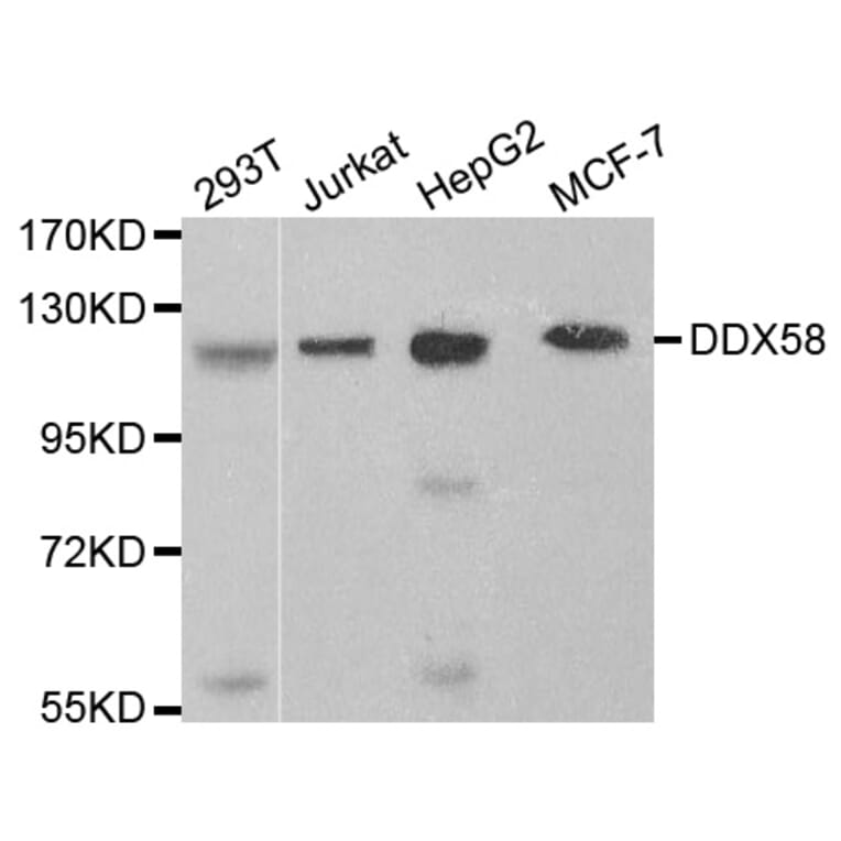 Western blot - DDX58 Antibody from Signalway Antibody (32076) - Antibodies.com