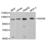 Western blot - DDX58 Antibody from Signalway Antibody (32076) - Antibodies.com