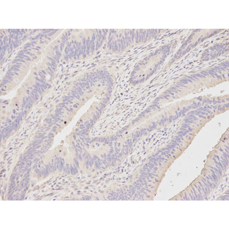 Immunohistochemistry - DDX58 Antibody from Signalway Antibody (32076) - Antibodies.com