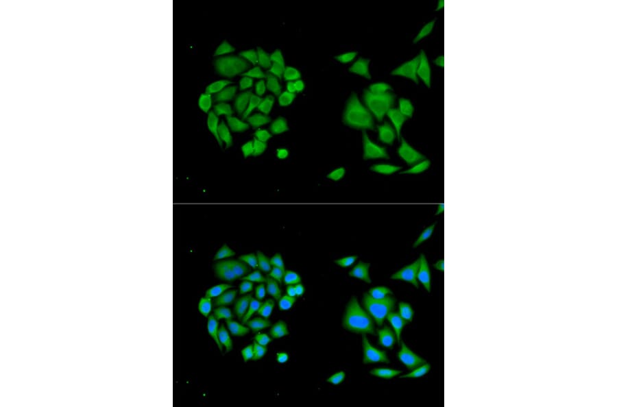 Immunofluorescence - DDX58 Antibody from Signalway Antibody (32076) - Antibodies.com