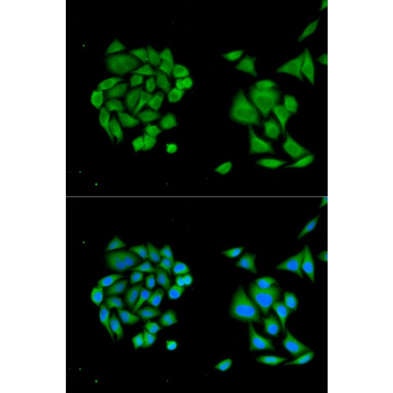 Immunofluorescence - DDX58 Antibody from Signalway Antibody (32076) - Antibodies.com