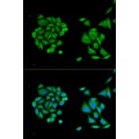 Immunofluorescence - DDX58 Antibody from Signalway Antibody (32076) - Antibodies.com