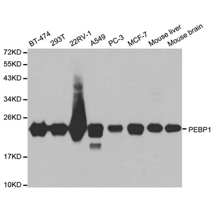 Western blot - PEBP1 Antibody from Signalway Antibody (32078) - Antibodies.com