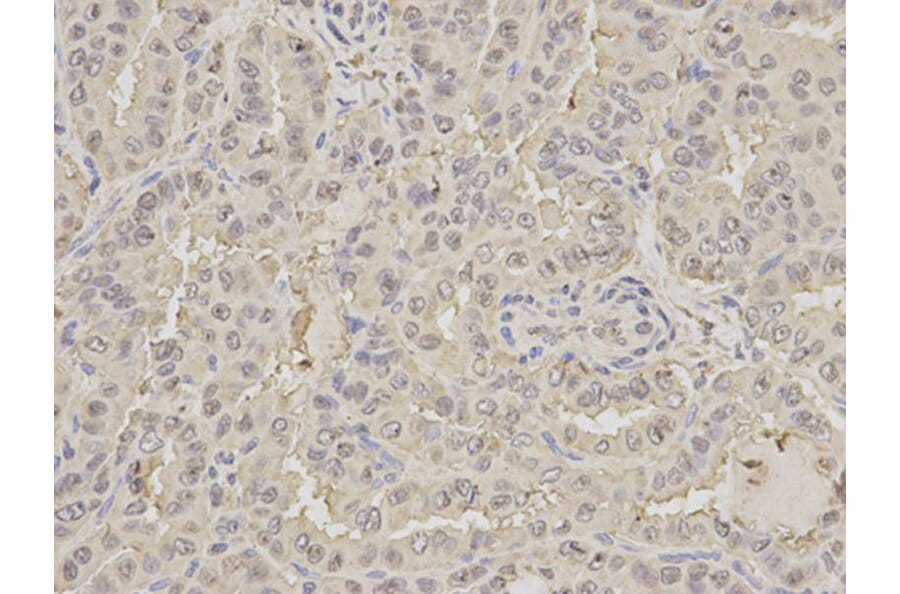 Immunohistochemistry - PEBP1 Antibody from Signalway Antibody (32078) - Antibodies.com