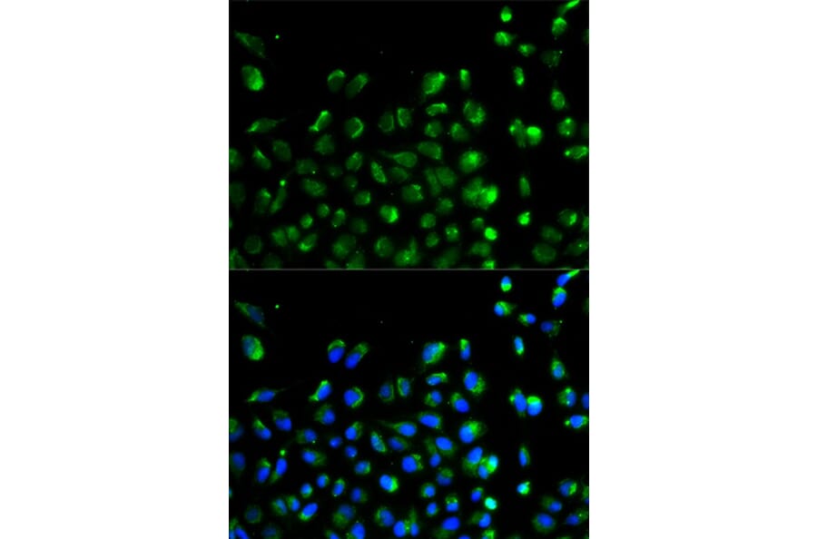 Immunofluorescence - ATG13 Antibody from Signalway Antibody (32084) - Antibodies.com