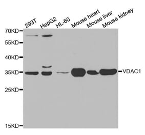 Western blot - VDAC1 Antibody from Signalway Antibody (32089) - Antibodies.com