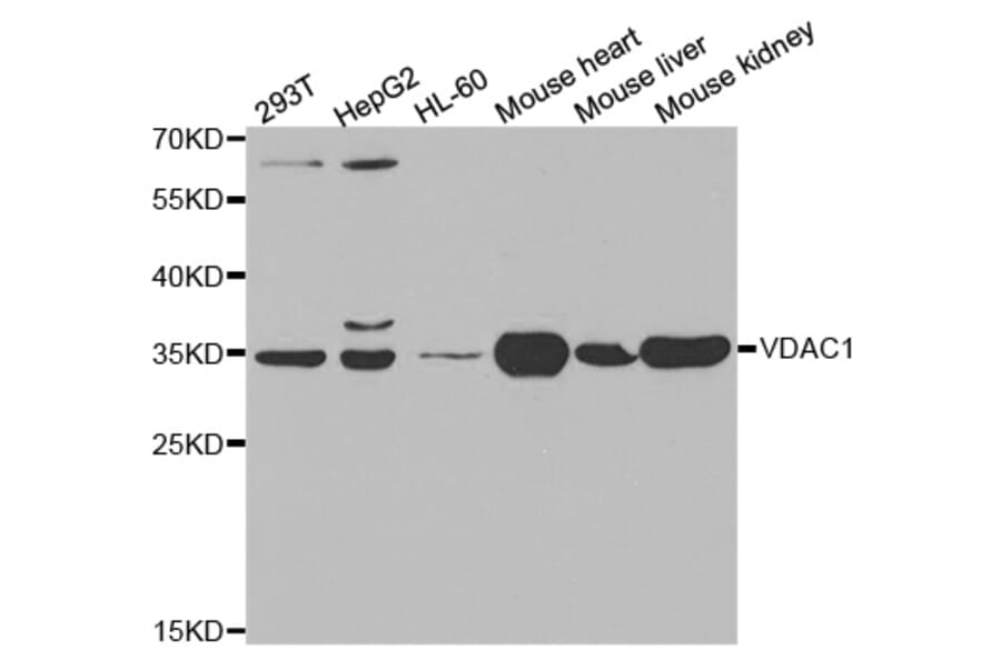 Western blot - VDAC1 Antibody from Signalway Antibody (32089) - Antibodies.com