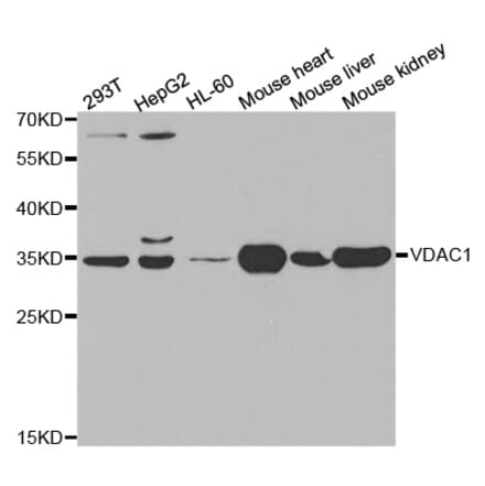 Western blot - VDAC1 Antibody from Signalway Antibody (32089) - Antibodies.com