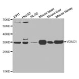 Western blot - VDAC1 Antibody from Signalway Antibody (32089) - Antibodies.com