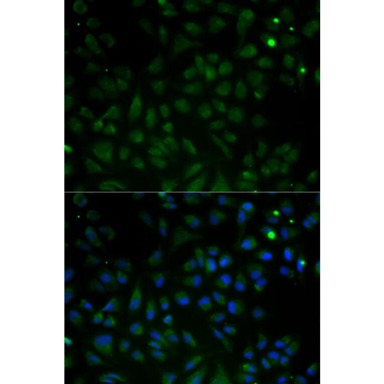Immunofluorescence - VDAC1 Antibody from Signalway Antibody (32089) - Antibodies.com
