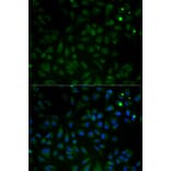 Immunofluorescence - VDAC1 Antibody from Signalway Antibody (32089) - Antibodies.com