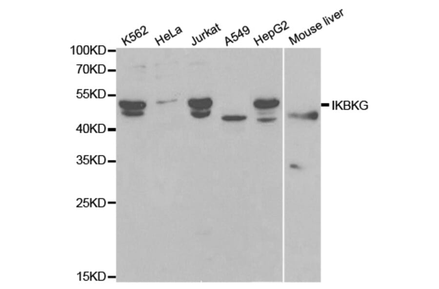 Western blot - IKBKG Antibody from Signalway Antibody (32092) - Antibodies.com