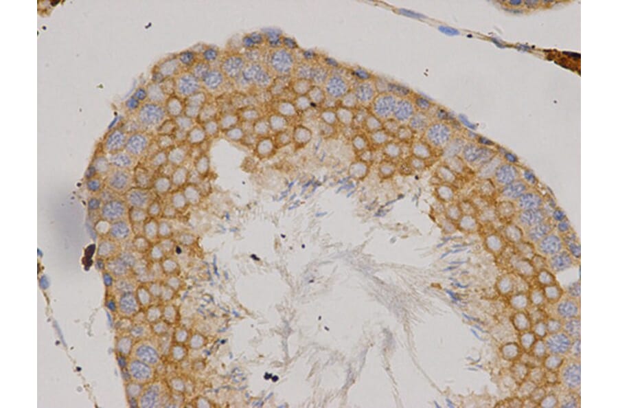 Immunohistochemistry - IKBKG Antibody from Signalway Antibody (32092) - Antibodies.com