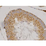 Immunohistochemistry - IKBKG Antibody from Signalway Antibody (32092) - Antibodies.com