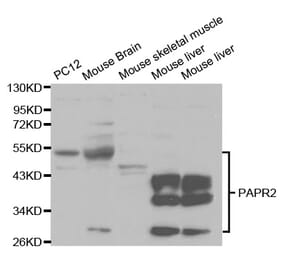 Western blot - PARK2 Antibody from Signalway Antibody (32097) - Antibodies.com