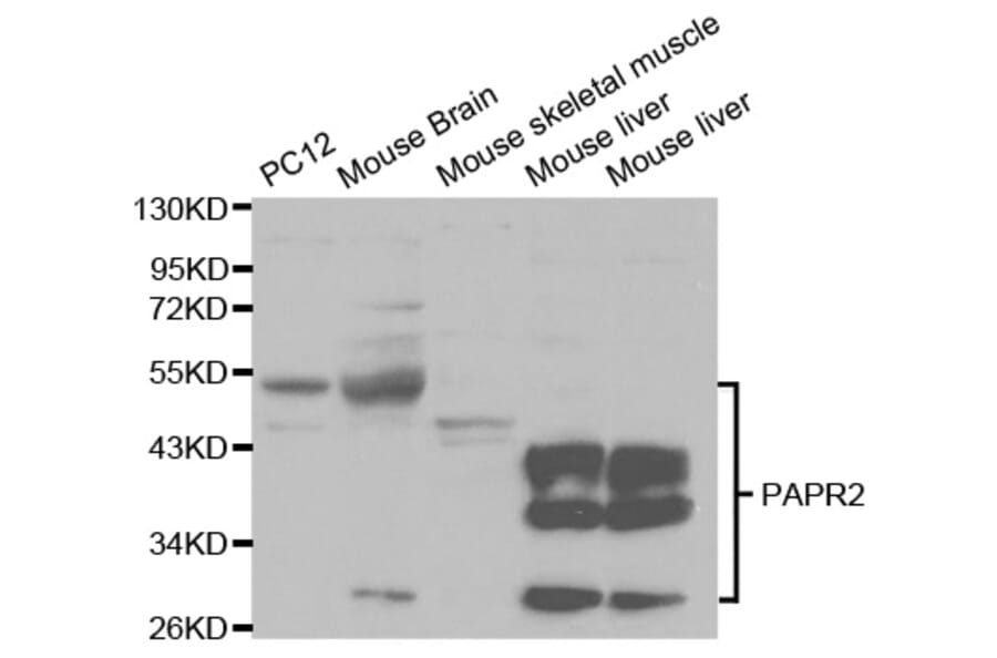Western blot - PARK2 Antibody from Signalway Antibody (32097) - Antibodies.com