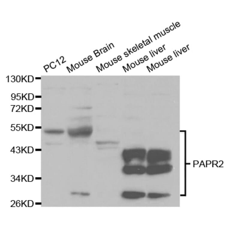 Western blot - PARK2 Antibody from Signalway Antibody (32097) - Antibodies.com